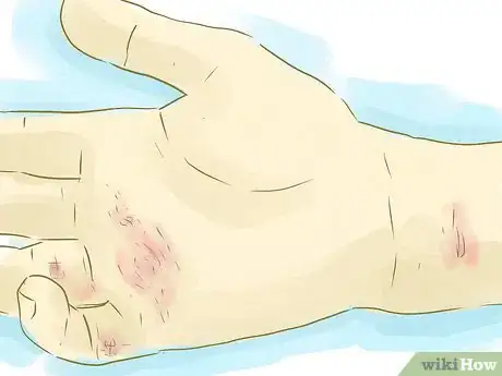 Image titled Have Flawless Skin in a Week Step 2Bullet2