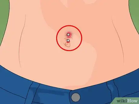 Image titled Care for a New Navel Piercing Step 15