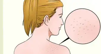 Use Aromatherapy for Relaxation