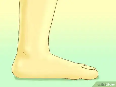 Image titled Look After Your Child's Feet Step 12