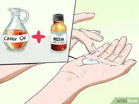 Image titled Get Rid of a Rash Between Your Legs Step 10