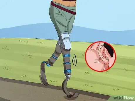 Image titled Care for Your Prosthesis Step 3