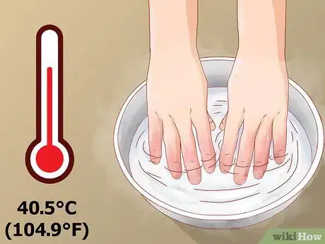 Image titled Recognize Frostbite Step 9