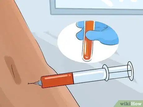 Image titled Recognize and Treat Kawasaki Disease Step 11