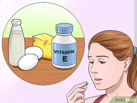 Image titled Prevent Stretch Marks Step 6