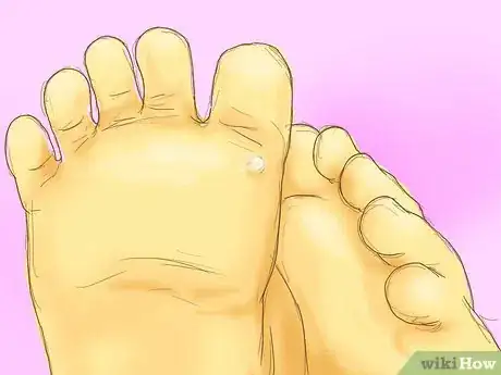 Image titled Look After Your Child's Feet Step 11
