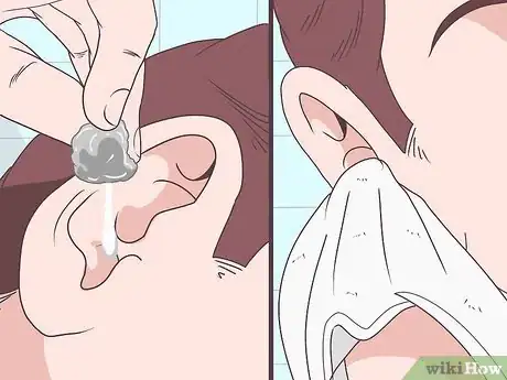 Image titled Use Hydrogen Peroxide Step 4