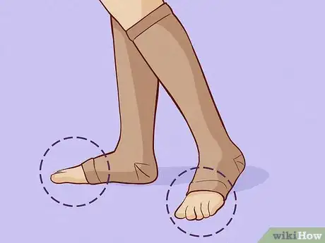 Image titled Buy Compression Socks Step 8