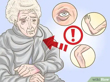 Image titled Report Elder Abuse in Idaho Step 6