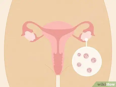 Image titled Get Ovarian Reserve Testing Done Step 1