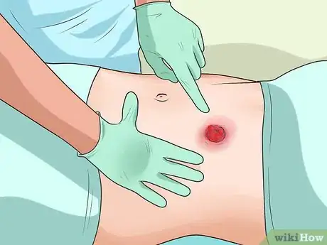 Image titled Recover from Crohn's Surgery Step 8