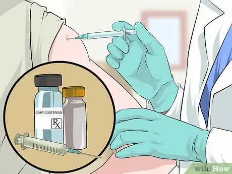 Image titled Reduce Scarring from Eczema Step 6