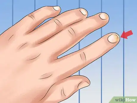 Image titled Keep Your Nails Healthy Step 16