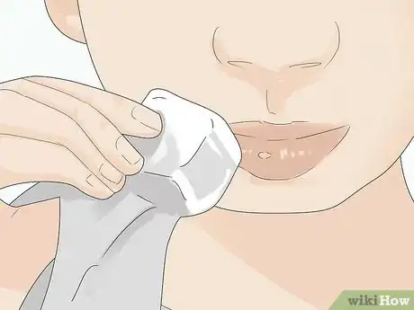 Image titled Soothe Mouth Ulcers in Toddlers Step 1