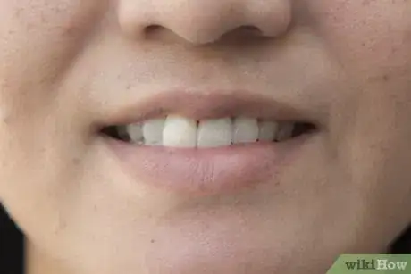 Image titled Whiten Your Teeth with Banana Peel Step 5Bullet1