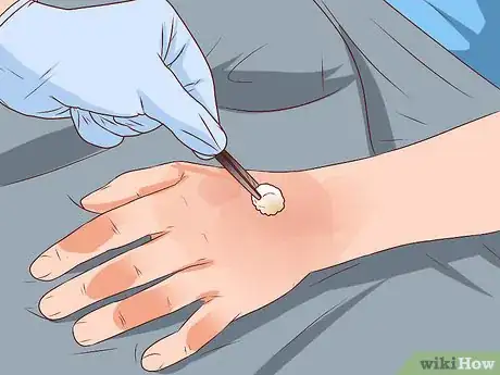 Image titled Reduce the Risk of Hospital Spread Infections Step 18