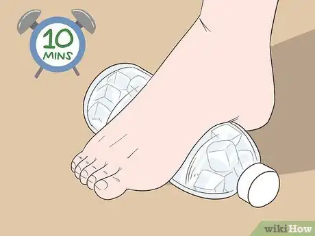 Image titled Wear a Dorsal Night Splint Step 12