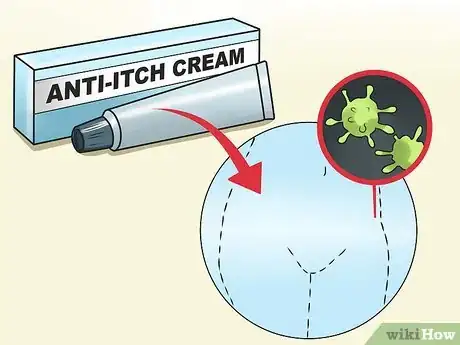 Image titled Stop Vaginal Itching Step 4