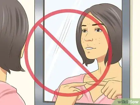 Image titled Not Let Acne Get You Down Step 12