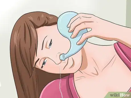 Image titled Cure Post Nasal Drip Step 6