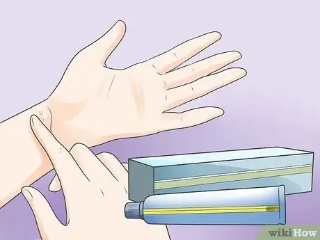 Image titled Recognize Scabies Rash Step 9