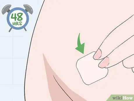 Image titled Use a Contraceptive Patch Step 5