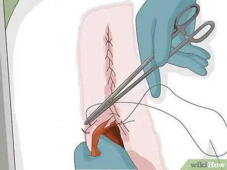 Image titled Perform a Caesarean Section on a Cow or Heifer Step 17