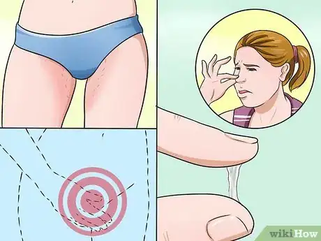 Image titled Stop Vaginal Itching Step 10