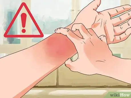 Image titled Measure Blood Oxygen Step 11