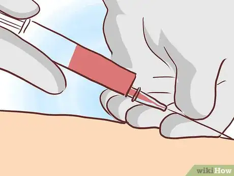 Image titled Pinpoint Food Allergies Step 13