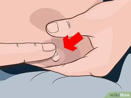 Image titled Avoid Sore Nipples While Breast Feeding Step 17