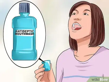 Image titled Heal a Sore Tongue Step 11