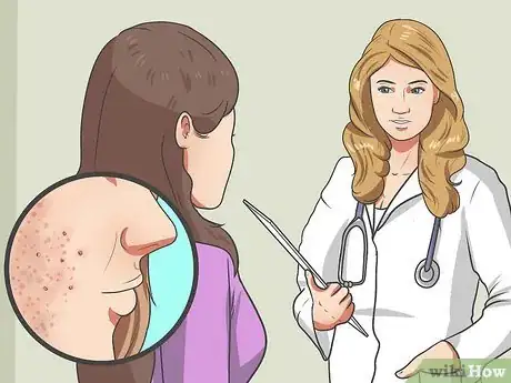 Image titled Start Using Accutane Step 1