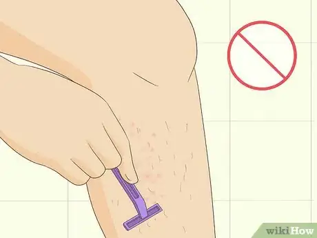 Image titled Soothe Itchy Legs Step 25