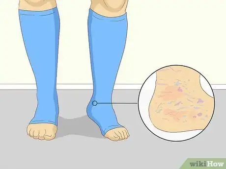 Image titled Soothe Itchy Legs Step 32