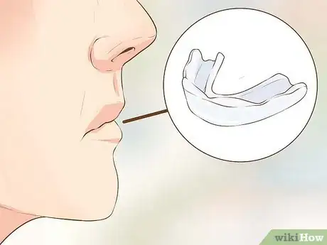 Image titled Have Great Teeth Step 12