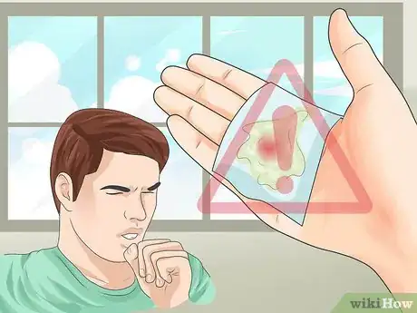 Image titled Diagnose Mitral Stenosis Step 3