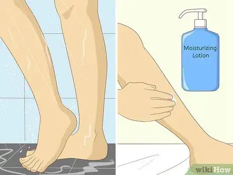 Image titled Soothe Itchy Legs Step 10