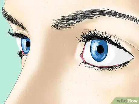 Image titled Treat Dissociative Fugue Step 7