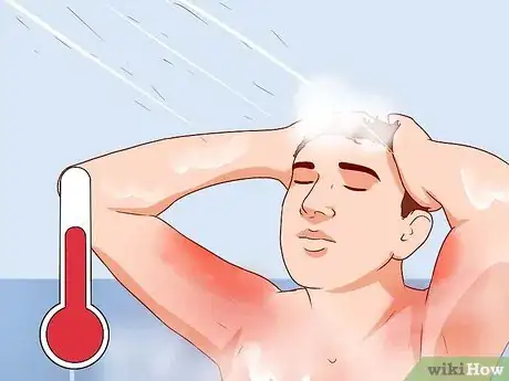 Image titled Relieve Discomfort Caused by Eczema Step 1