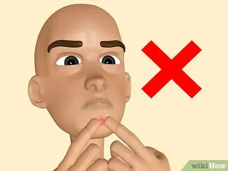 Image titled Make Your Own Acne Treatment Step 13