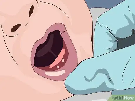 Image titled Avoid Sore Nipples While Breast Feeding Step 14
