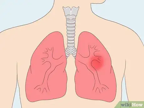 Image titled Have Plastic Surgery Step 6