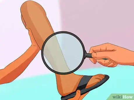 Image titled Care for Your Prosthesis Step 4