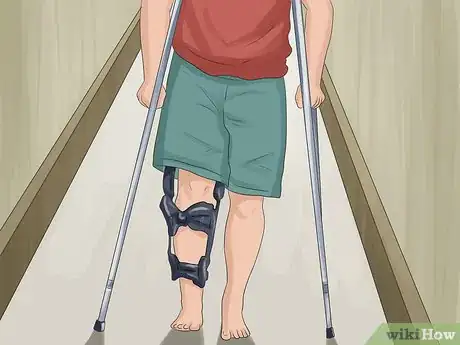 Image titled Identify a Broken Femur Step 4