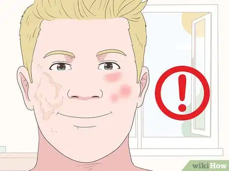 Image titled Use Retinol Step 9