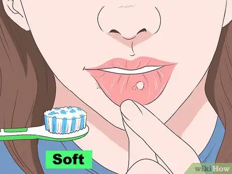 Image titled Live with Breast Cancer Step 16