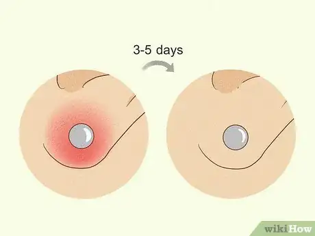 Image titled Treat Infected Piercings Step 13