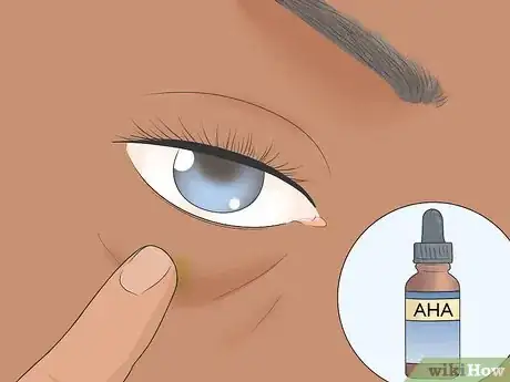 Image titled Treat Under Eye Wrinkles Step 5