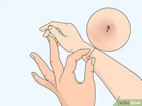 Image titled Treat Insect Bites in Toddlers Step 4